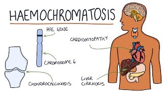 Understanding Haemochromatosis [upl. by Annot926]