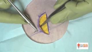 How to Close a Wound with Surgical Staples [upl. by Doti]