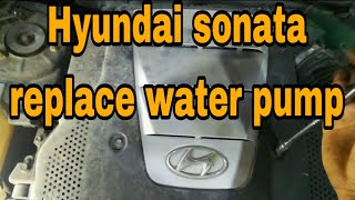 How To Replace Water Pump In Hyundai Sonata [upl. by Swetlana844]