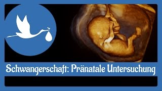 Schwangerschaft Pränatale Untersuchung [upl. by Adoree]