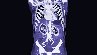 A Man Ate 2 Pounds Licorice Candy This Is What Happened To His Organs [upl. by Elleinod]