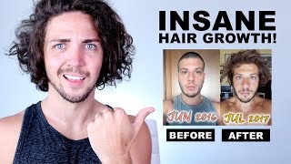 ✅ Awkward Stage Inspiration  INSANE Hair Growth Time Lapses [upl. by Oicnedurp429]