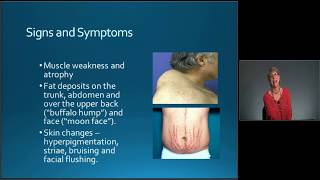 MedicalSurgical Nursing Exam Review Endocrine Disorders  MEDED [upl. by Norword]